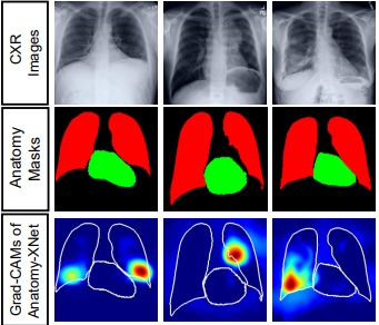 Anatomy-XNet: Thoracic Disease Classifier for Chest X-rays